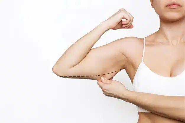 What Body Areas Can Be Treated by Liposuction? 5 Untitled design 2025 07 17T153635.695 1
