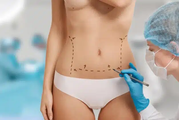 What Body Areas Can Be Treated by Liposuction? 1 Untitled design 2025 07 17T153704.561 1
